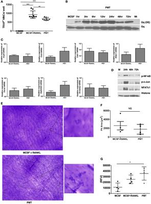 Pasteurella multocida Toxin Triggers RANKL-Independent Osteoclastogenesis